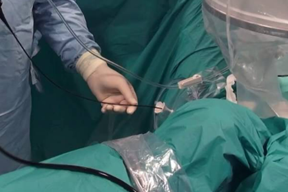 Important Things About Best Gyno Surgeon